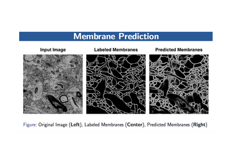 Membrane Detection